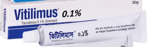 Vitilimus